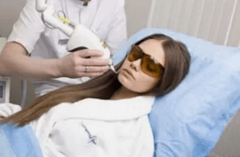 fractional laser αναζωογόνηση